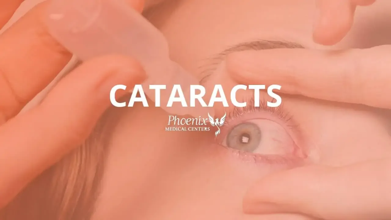 How Cataracts Affect Your Vision