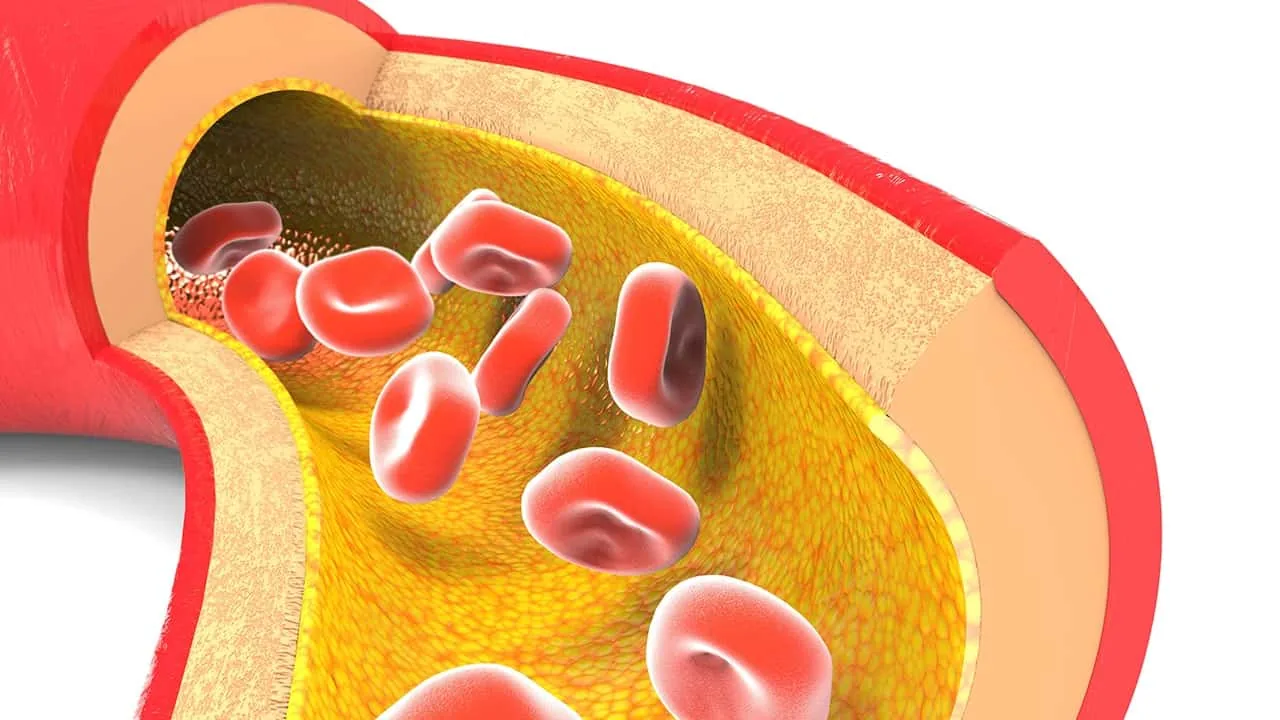 How Diabetes Affects Your Body